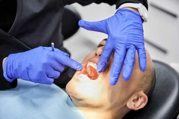 Best Emergency Wisdom Tooth Extraction in West Point, NE